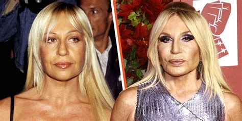 donatella versace facelift|Donatella Versace without plastic surgery.